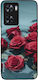 Sonique Silikon Rückseite Rosa (Oppo A57 4G)