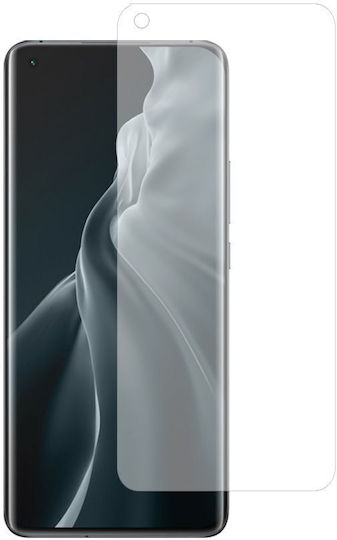 0.3mm Tempered Glass (Mi 11 / Mi 11 Ultra)