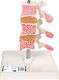 Manechin De Antrenament Medical Osteoporoză 1000153