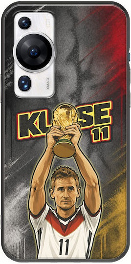 Калъф World Stars Collection Miroslav Klose Huawei P60 Pro Черен TPU Силикон