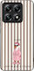 Sonique Stripe Stories Series Xiaomi Xiaomi 14t...
