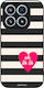 Sonique Stripe Stories Series Xiaomi Xiaomi 17 ...