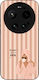 Sonique Stripe Stories Series Xiaomi Xiaomi 17 ...
