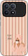 Sonique Stripe Stories Series Xiaomi Poco F8 Pr...
