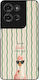 Θήκη Sonique Stripe Stories Series Motorola Mot...