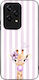 Husă Sonique Stripe Stories Series Honor 200 Li...