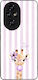 Husă Sonique Stripe Stories Series Honor 200 Pr...