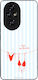 Husă Sonique Stripe Stories Series Honor 200 Pr...