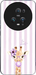 Sonique Stripe Stories Series Honor Magic5 Pro ...