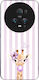 Sonique Stripe Stories Series Honor Magic5 Pro ...