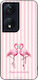 Θήκη Sonique Stripe Stories Series Honor 90 Sma...