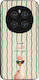 Θήκη Sonique Stripe Stories Series Honor Magic7...