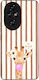 Husă Sonique Stripe Stories Series Honor 200 Pr...