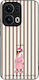 Sonique Case Stripe Stories Series Oppo Reno13 ...