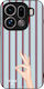 Sonique Stripe Stories Series Oppo Find X9 Pro ...