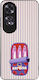 Husă Sonique Stripe Stories Series Oppo A60 Sar...
