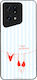 Sonique Stripe Stories Series Case Oppo Find X5...