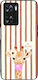 Sonique Stripe Stories Series Case Oppo A57 4G ...