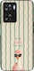 Sonique Stripe Stories Series Case OnePlus Nord...