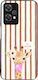 Sonique Stripe Stories Series Case OnePlus Nord...