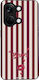 Sonique Stripe Stories Series OnePlus Nord 3 5G...