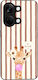 Sonique Stripe Stories Series OnePlus Nord 3 5G...