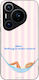 Sonique Stripe Stories Series Huawei Pura 70 Pr...