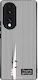 Калъф Sonique Stripe Stories Series Honor 70 5g...