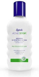 Zdrave Acne Stop Lotion Καθαρισμού Προσώπου 150ml