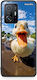 Smartfits Duck Face Xiaomi 11t 11t Pro Θήκη